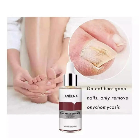 Lanbena - Nail Repair Essence